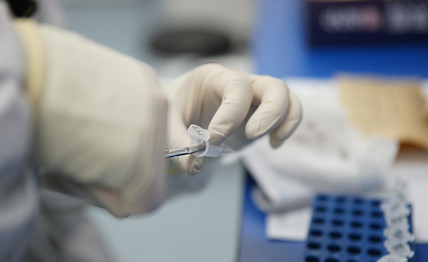 楚雄偷偷做亲子鉴定如何做,楚雄亲子鉴定办理方法